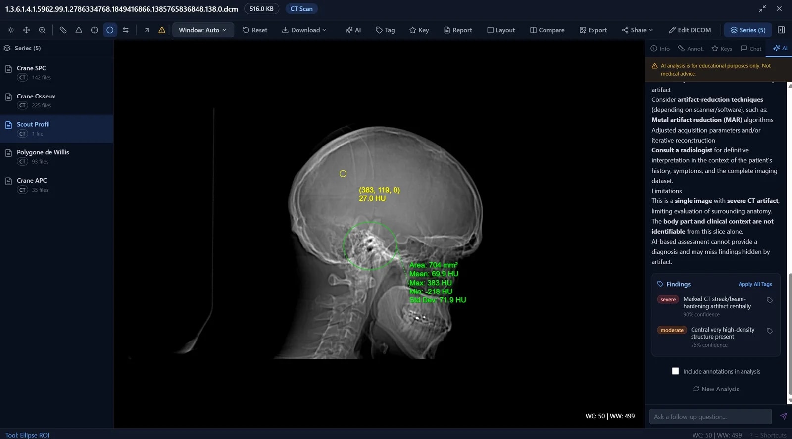 BigMind Medical DICOM viewer with measurement tools and window presets