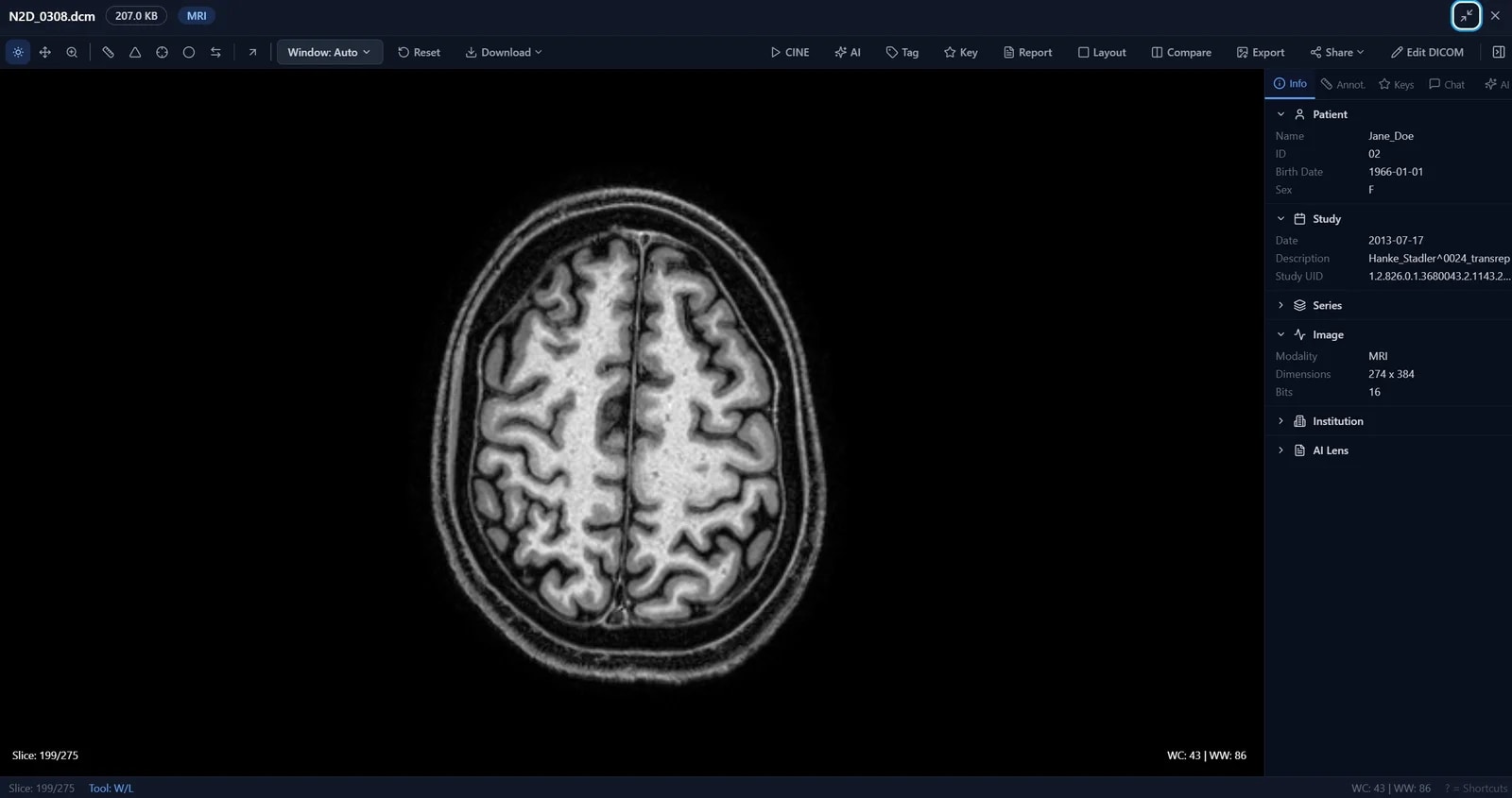 AI Lens Medical — DICOM viewer inside a partner-branded BigMind Resilience dashboard