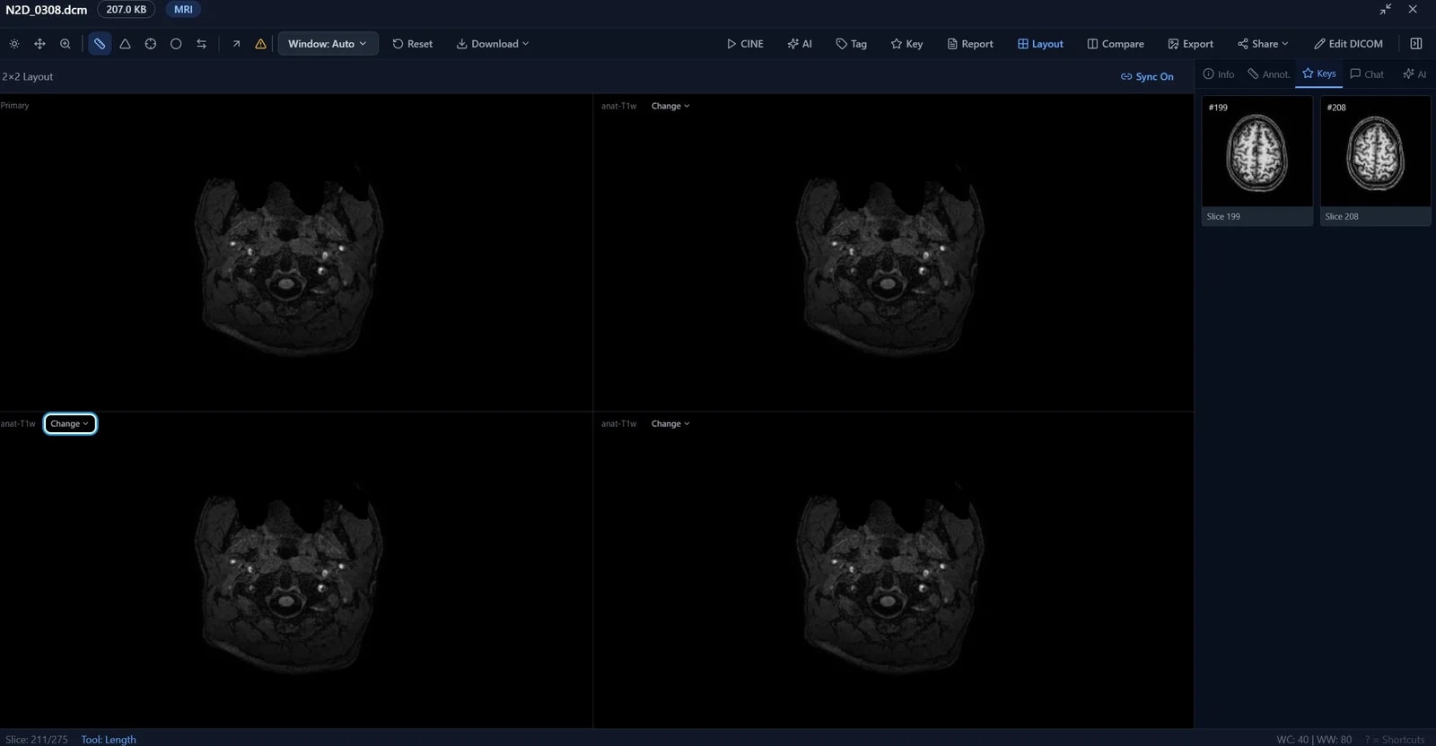 AI Lens Medical DICOM viewer — multi-pane study view with window/level controls